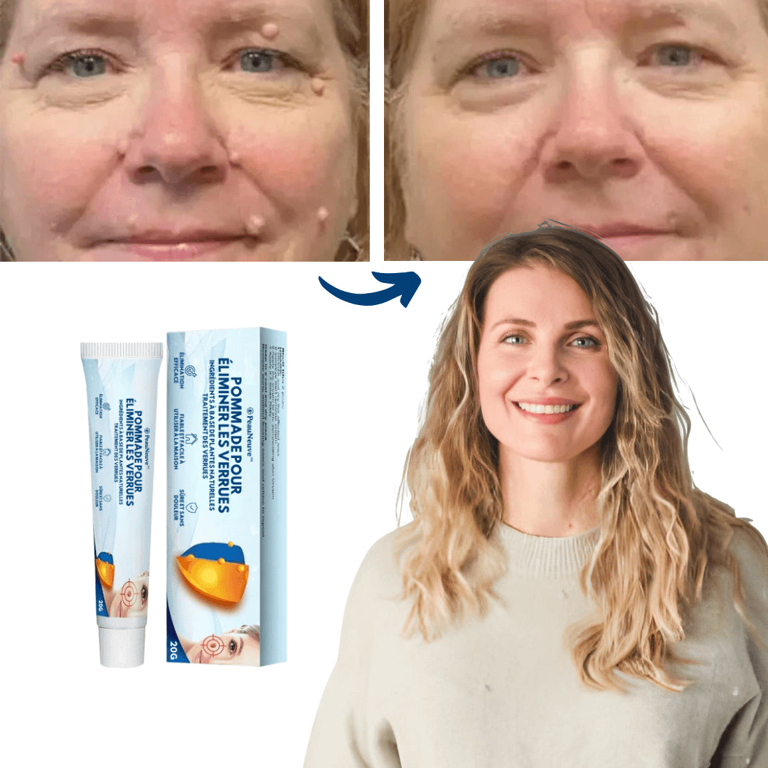 PeauNeuve™ Crème